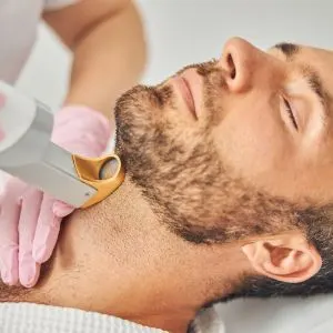 Best Beard hair removal in Pune