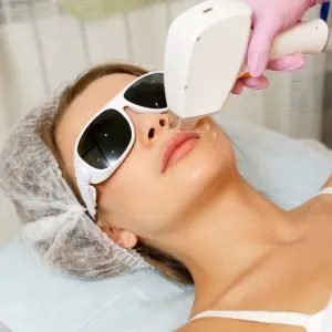 Upper lip hair removal in Pune