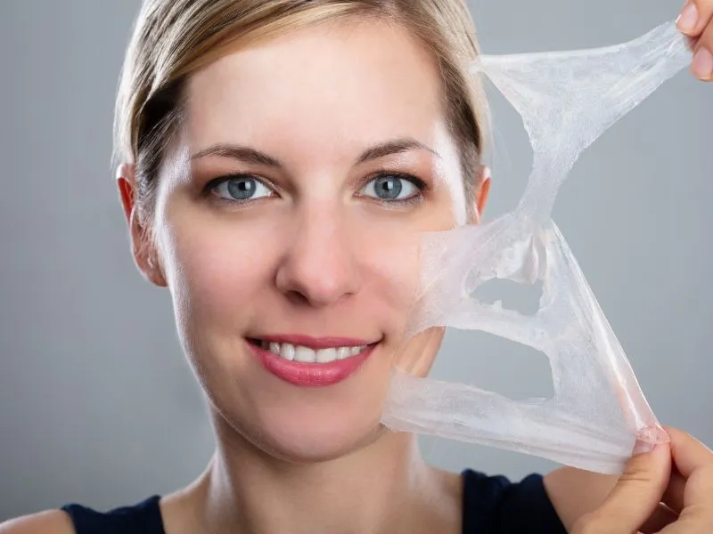 Benefits of Chemical Peel Treatment